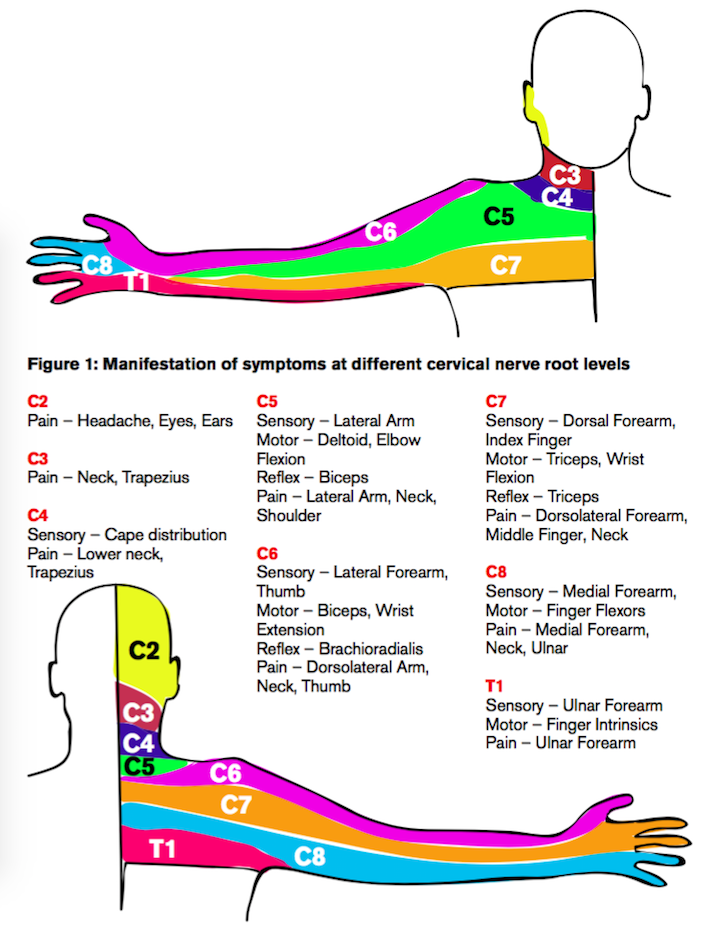 tramadol help with cervical radiculopathy treatments