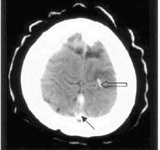 Digest of Dr. Herbert’s Monthly Audio CME Series: Miss diagnoses