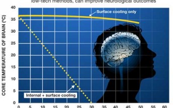 Is CPR effective? Can ice save a life? Rethinking Resuscitation
