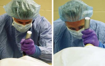 Avoiding Common Laryngoscopy Errors