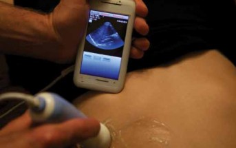 The Next Big (small) Thing:  Smartphone-Powered Ultrasound