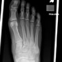 65-year-old female with a foot injury
