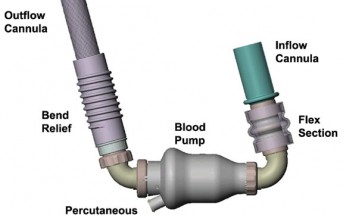 The LVAD: Walking, Talking … and Pulseless