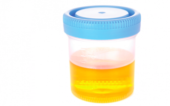 The Urine Screen: How Reliable is it Really?