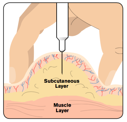 The Right Route The Site Of Injection Matters Emergency Physicians Monthly