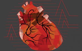 Remote Ischemic Conditioning: New Adjunct for STEMI Care?