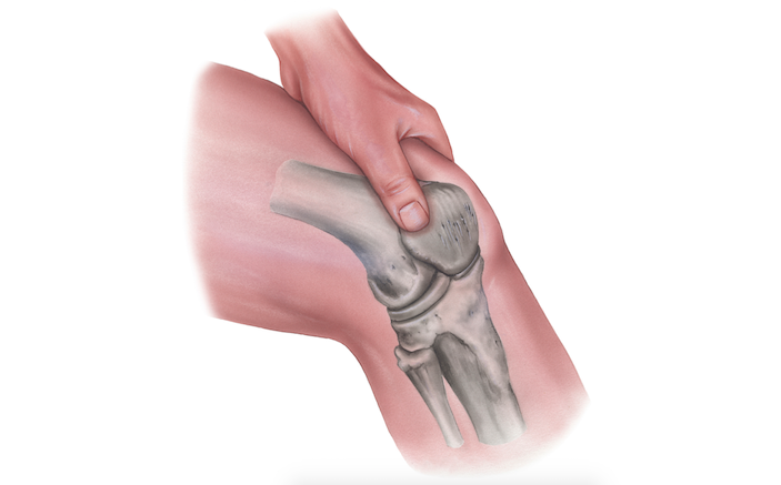 How To Confidently Rule Out Traumatic Arthrotomy Of The Knee