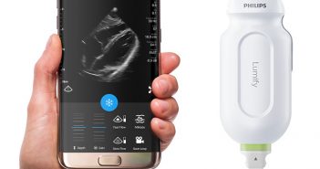 lumify-ultrasound-systems