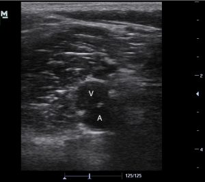 Ultrasound Image 4