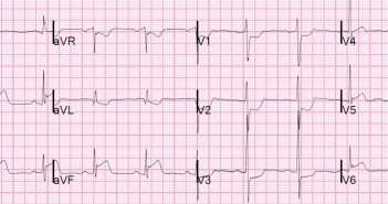 EKG image-9