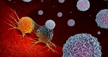 Cancer Immunotherapy