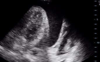 Ultrasound for the drowning heart: Part 2
