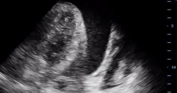 Ultrasound Figure 3