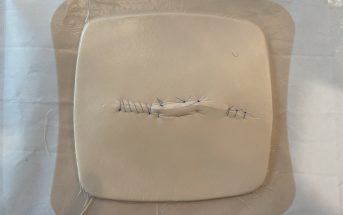 Train Yourself: Simple Strategy for Suturing Setup