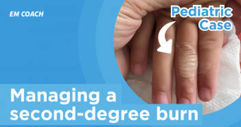 OCT22_How to Manage a 2nd Degree Burn