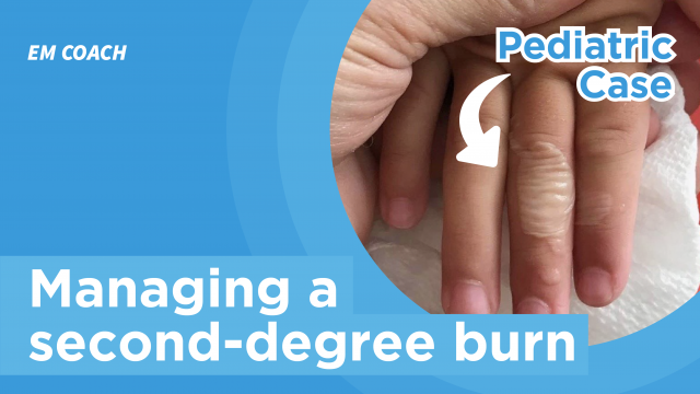 OCT22_How to Manage a 2nd Degree Burn