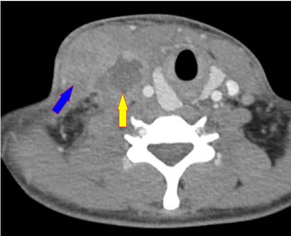 figure 3 de