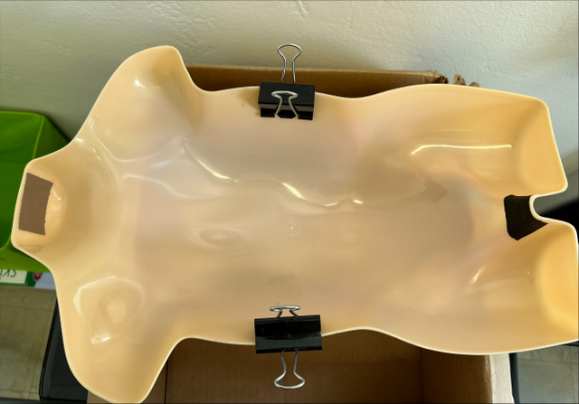 G-tube Replacement