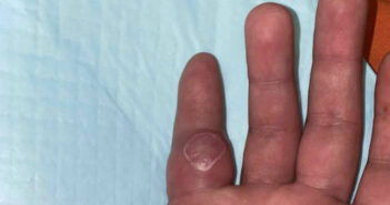 ultrasound pocus figure 1b.